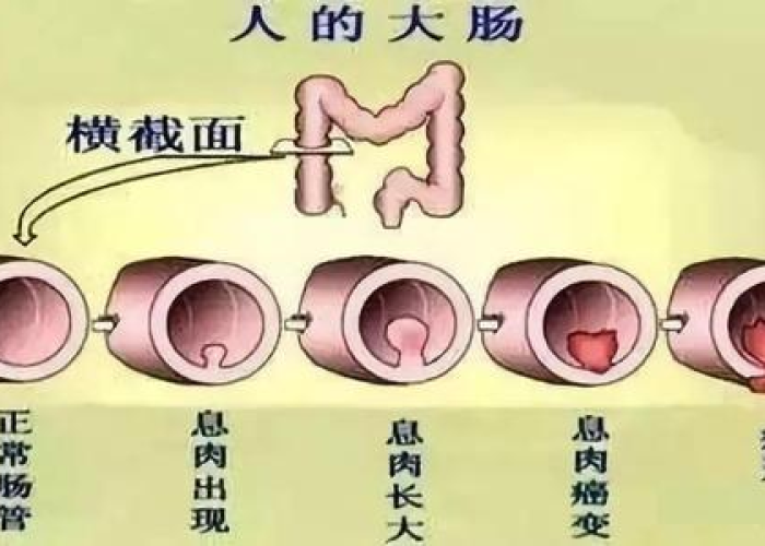 疫情最新中国数据图，疫情最新情况最新消息中国