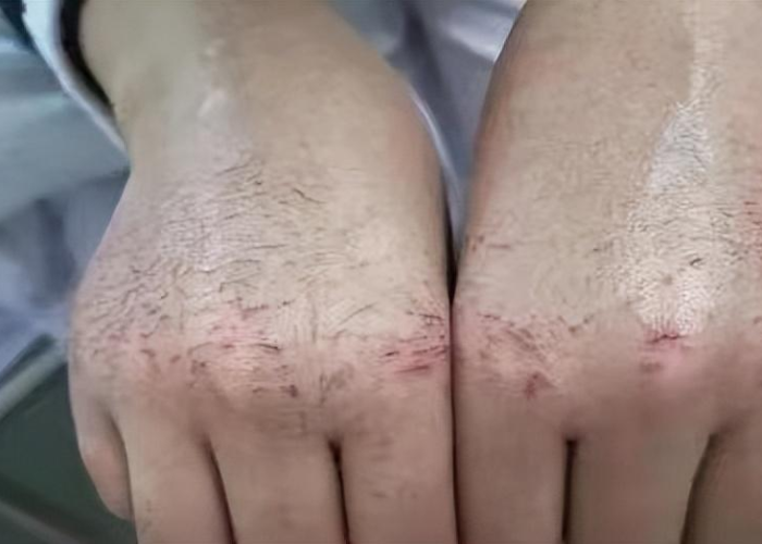 近期疫情有什么症状，近期疫情有什么症状和反应