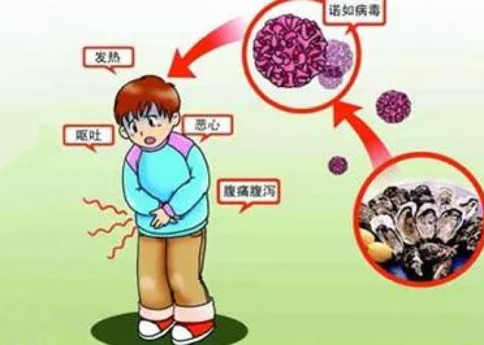 近期疫情是什么病毒引起的，近期疫情有什么症状