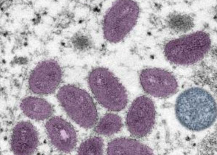 全球疫情死亡最新情况数据，全球疫情死亡多少人最新