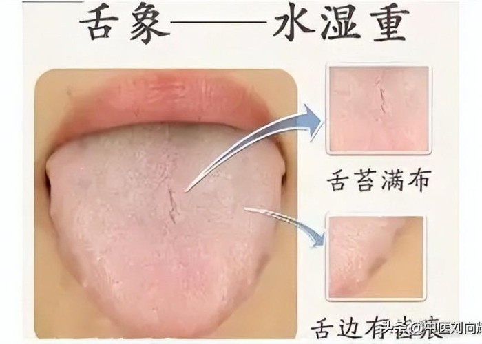 疫情什么开始放开的，疫情什么时候开始控制