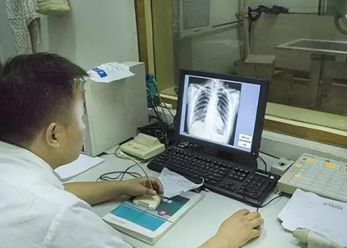 疫情到现在几年，疫情到现在几年人检查出肺结节很多